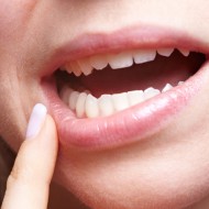 Как правильно лечить стоматит во рту у взрослых? Проверенные методы и способы
