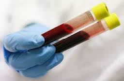 аст биохимический анализ крови
