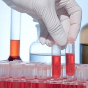 RBC в анализе крови