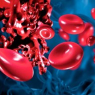 Как и чем разжижить кровь в домашних условиях быстро и с положительным результатом?