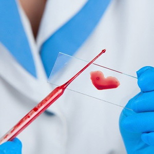 Анализ крови на стерильность