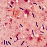 Клостридии в анализе на дисбактериоз: чем опасно повышение уровня бактерий?