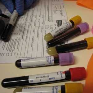 анализы крови