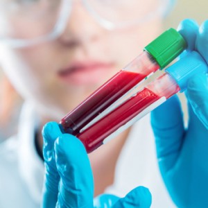 ГГТ в биохимическом анализе крови