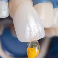 Современные технологии в стоматологии
